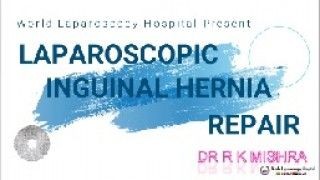 Davinci Robotic Adhesiolysis Surgery with Application of Interceed
