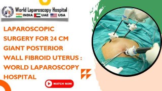 Laparoscopic Surgery for 24 cm Giant Fibroid Uterus at WLH