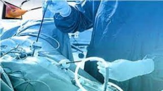 Laparoscopic Morcellator