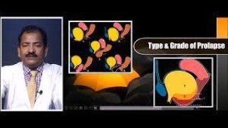 Surgeons Speak: Firsthand Accounts of Laparoscopic Training at World Laparoscopy Hospital