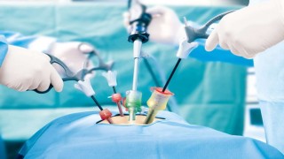 Laparoscopic Ventral Hernia repair by Dr R K Mishra