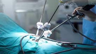 Laparoscopic Incisional Hernia Repair after previous Mc Burney's incision