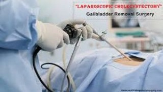 Laparoscopic Repair of Duodenal Perforation Lecture by Dr R K Mishra