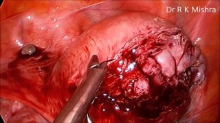 How to Reach World Laparoscopy Hospital?