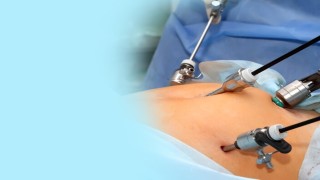 Advancing Minimally Invasive Care: Laparoscopic Solutions for Endometriosis & Adenomyosis