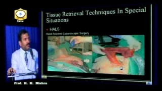 Laparoscopic Morcellator
