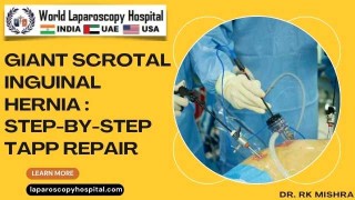 Giant Scrotal Inguinal Hernia: Step-by-Step TAPP Laparoscopic Repair