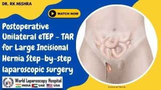 Unilateral eTEP-TAR: Laparoscopic Solution for Large Incisional Hernia