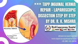 Mastering TAPP Hernia Repair: A Stepwise Laparoscopic Approach