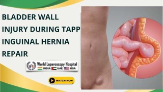 Managing Bladder Injury During TAPP Hernia Repair: Step-by-Step