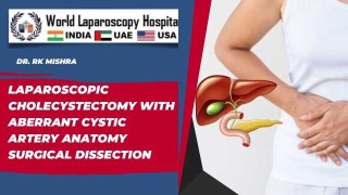 Aberrant Cystic Artery: Safe Laparoscopic Dissection in Cholecystectomy
