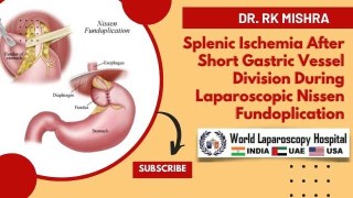 Splenic Ischemia: A Rare Complication of Laparoscopic Nissen Fundoplication