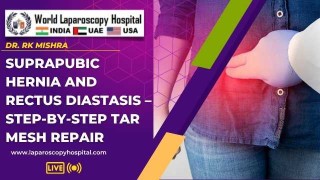 TAR Mesh Repair for Suprapubic Hernia with Rectus Diastasis