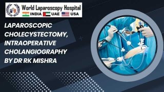 Laparoscopic Gallbladder Removal with Real-Time Intraoperative Cholangiography
