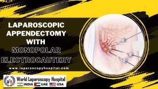 Laparoscopic Hysterectomy with Ureteral Stent Placement for Optimal Patient Care