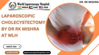 Essential Laparoscopic Cholecystectomy: Step-by-Step Safe Gallbladder Removal