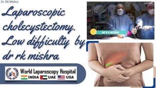 Standard Laparoscopic Cholecystectomy: Low-Difficulty Surgical Approach