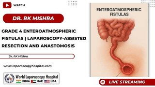Laparoscopy-Assisted Management of Grade IV Enteroatmospheric Fistulas