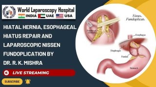 Anti-Reflux Barrier: Laparoscopic Hiatal Hernia Repair with Nissen Fundoplication