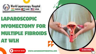 Laparoscopic Myomectomy for Multiple Fibroids at WLH | Excellent Minimally Invasive Technique in WLH