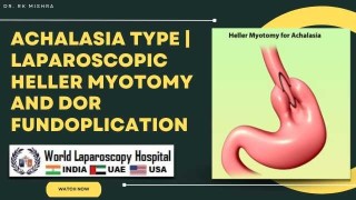 Precision Relief: Advanced Laparoscopic Heller Myotomy with Dor Fundoplication for Achalasia