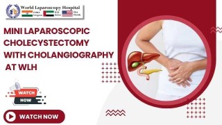 Mini Laparoscopic Cholecystectomy Enhanced with Intraoperative Cholangiography