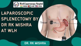 Laparoscopic Splenectomy for ITP: Safe, Effective & Organ-Sparing Technique