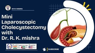 Ultra-Minimally Invasive Care: Advancing Outcomes with Mini Laparoscopic Cholecystectomy