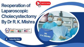 Second-Look Laparoscopy: Strategies and Outcomes in Reoperative Cholecystectomy