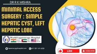 Minimally Invasive Management of a Left-Lobe Simple Hepatic Cyst: Techniques & Outcomes