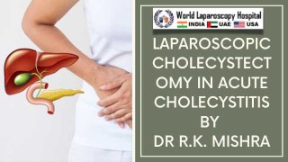 Safe Laparoscopic Cholecystectomy in Acute Cholecystitis