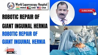 Robotic Repair of Complex Giant Inguinal Hernia | Cutting-Edge Hernia Surgery at WLH