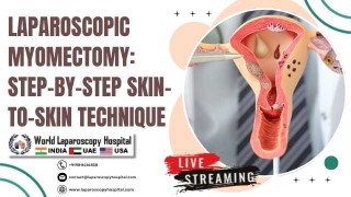 Laparoscopic Myomectomy: Step-by-Step Skin-to-Skin Technique