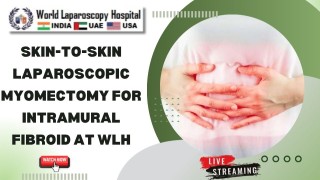 Skin-to-Skin Laparoscopic Myomectomy for Intramural Fibroid