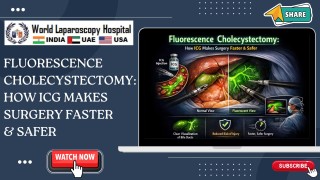 Fluorescence Cholecystectomy : Explains How ICG Enhances Surgical Safety and Speed