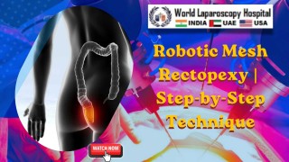Complete Rectal Prolapse Treatment with Robotic Mesh Rectopexy | Dr. R.K. Mishra