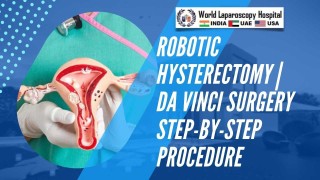 Laparoscopic Management of Dermoid Ovarian Cysts: A Comprehensive Stepwise Approach