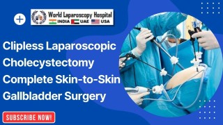 Clipless Laparoscopic Cholecystectomy | Skin-to-Skin Gallbladder Removal by Dr. R.K. Mishra