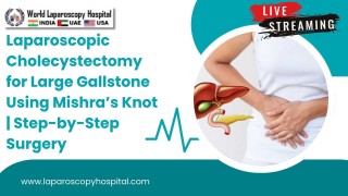 Laparoscopic Cholecystectomy for Giant Gallstone Using Mishra's Knot | Complete Surgery