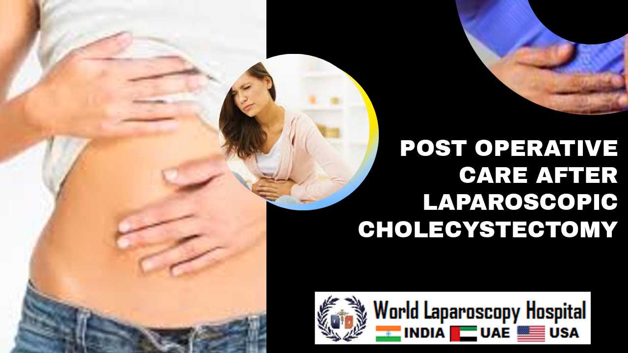 Important post operative care after laparoscopic cholecystectomy