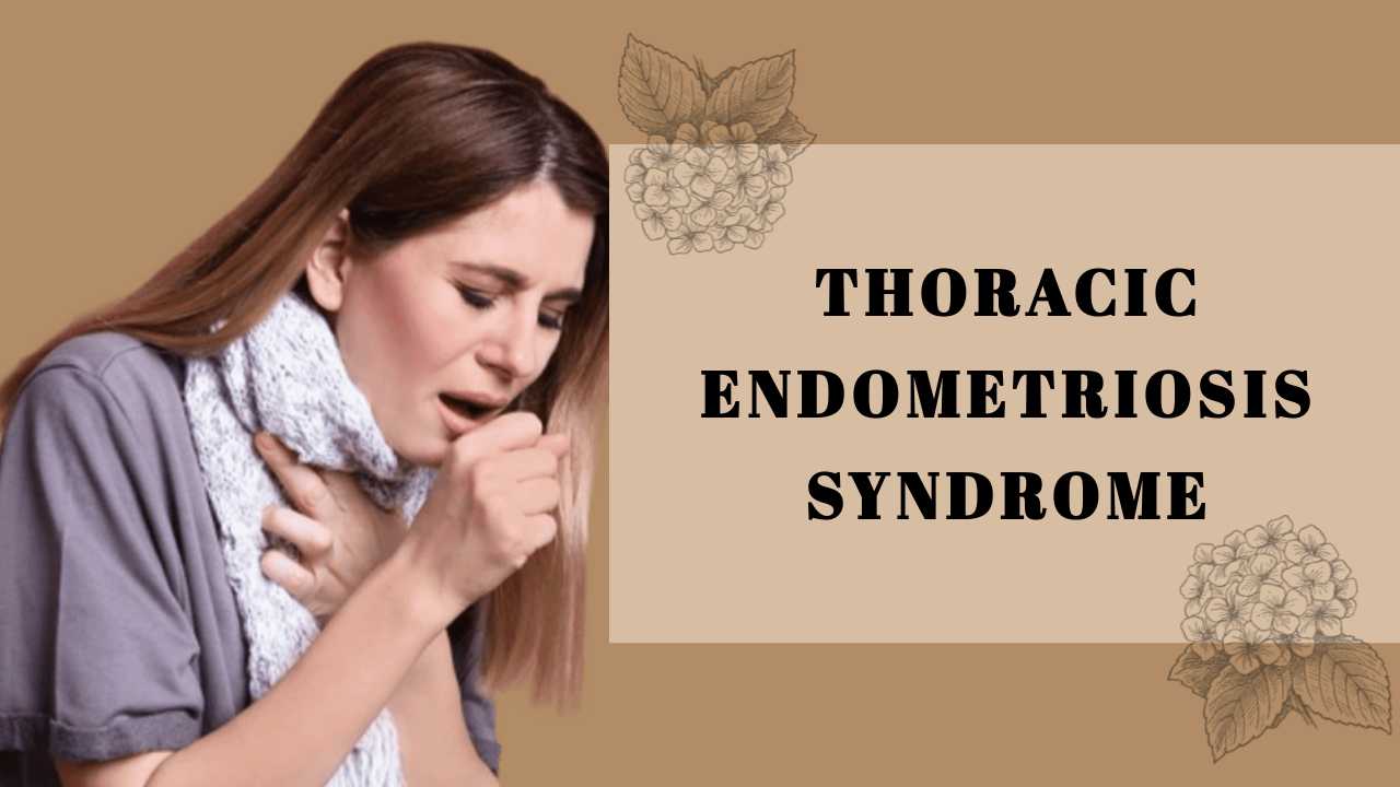 A case report of thoracic endometriosis – A rare cause of