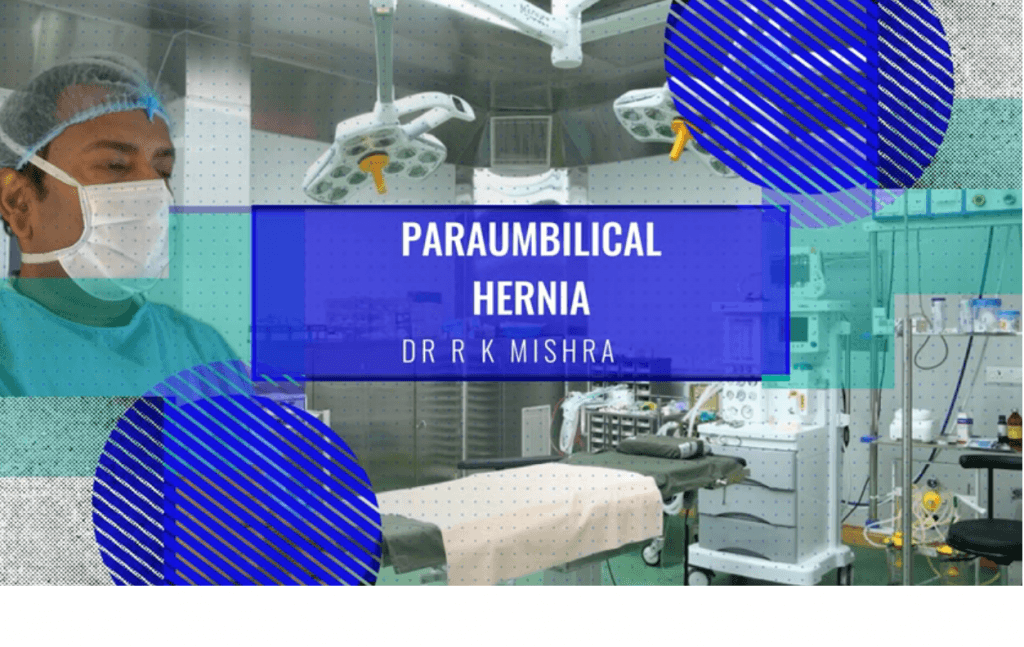 Para-umbilical Hernia IPOM Repair
