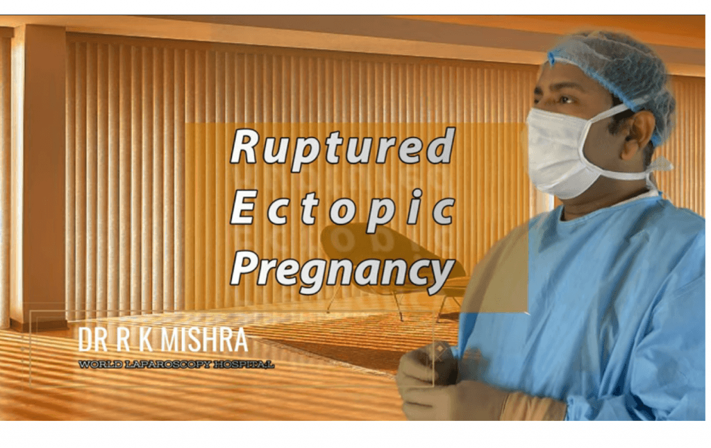 Ruptured Ectopic Pregnancy