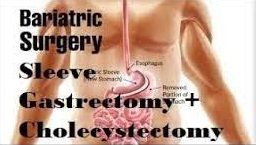 Robotic Sleeve Gastrectomy and Cholecystectomy
