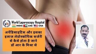 अपेंडिसाइटिस क्या होता है और इस्का लैप्रोस्कोपी से इलाज कैसे संभव है।