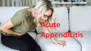 Laparoscopic Appendectomy for Acute Appendicitis (Retrocecal Appendix)
