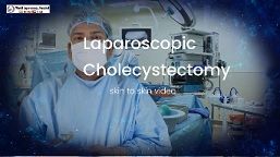 Skin to Skin Laparoscopic Cholecystectomy in 4K