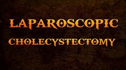 Laparoscopic Cholecystectomy Full Length Skin to Skin Video with Near Infrared Cholangiography