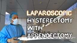 Laparoscopic Hysterectomy And Appendectomy Using Illuminated Ureteral Stent Step Step Demonstration