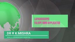 Laparoscopic Falope Ring Applicator